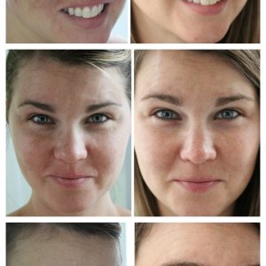 Rodan and Fields Before and After
